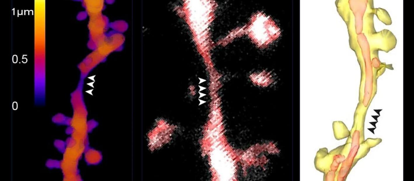 New Findings on Information Processing in the Brain: - Examples of Dendritic Shaft Constrictions (DSCs) imaged used high resolution microscopy techniques, expansion microscopy (left), STED (middle) and electron microscopy (right). Arrowheads indicate the position of DSCs.