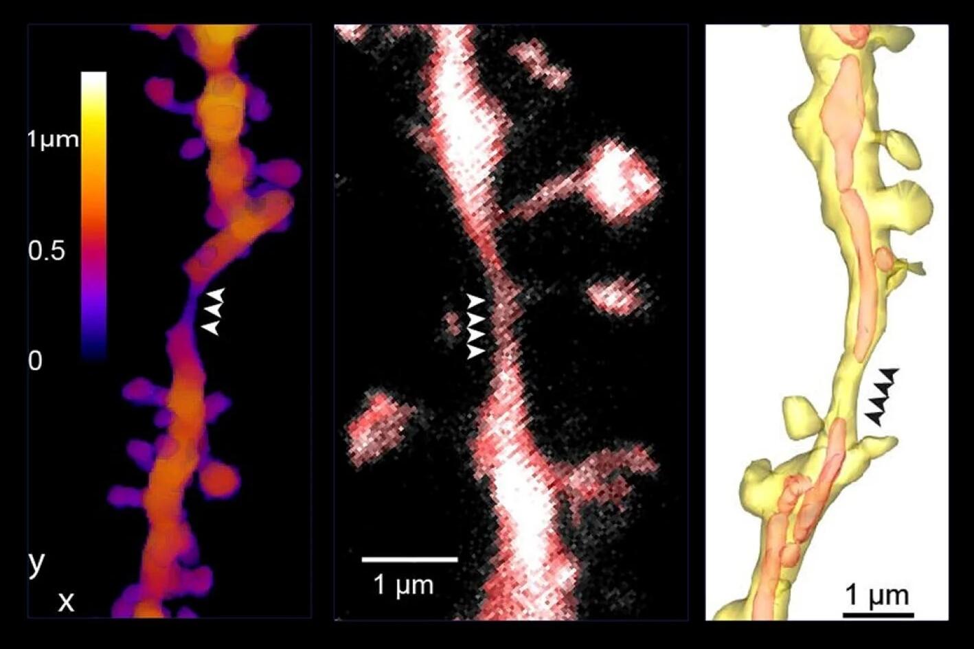 New Findings on Information Processing in the Brain: - Examples of Dendritic Shaft Constrictions (DSCs) imaged used high resolution microscopy techniques, expansion microscopy (left), STED (middle) and electron microscopy (right). Arrowheads indicate the position of DSCs.