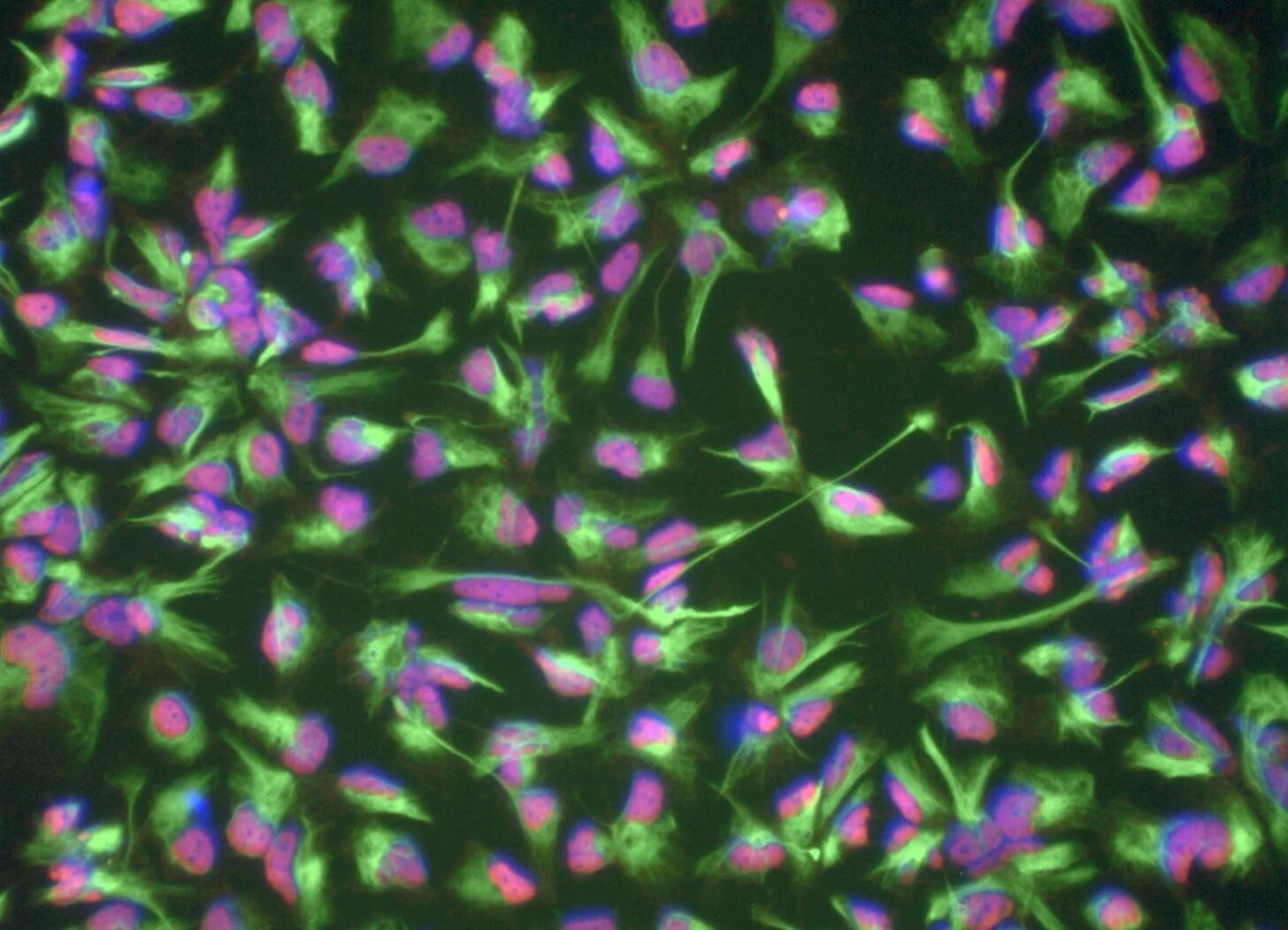 Induced neural stem cells (iNSCs) - derived from blood cells of a 101-year-old donor.