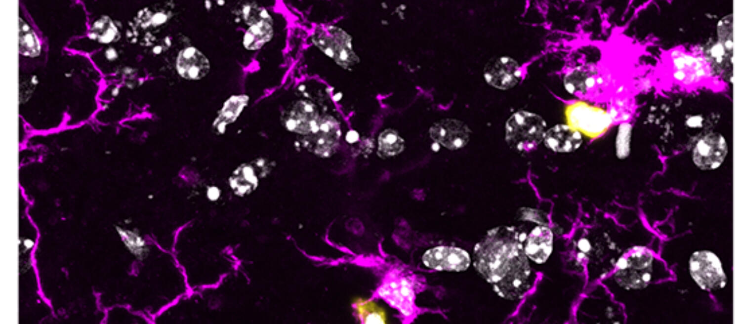 Microglia interacting with T cells in the central nervous system of SPG15-deficient mice