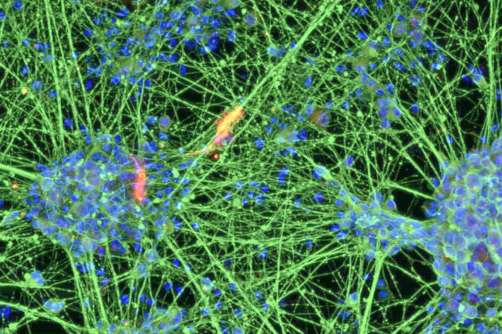 Neurons - generated through the differentiation of induced neural stem cells (iNSCs) derived from blood.