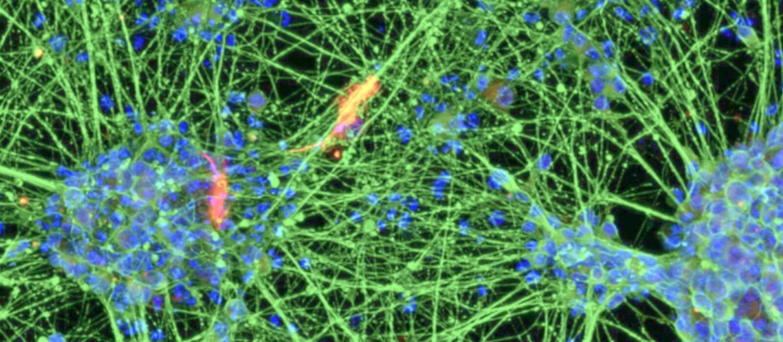 Neurons - generated through the differentiation of induced neural stem cells (iNSCs) derived from blood.
