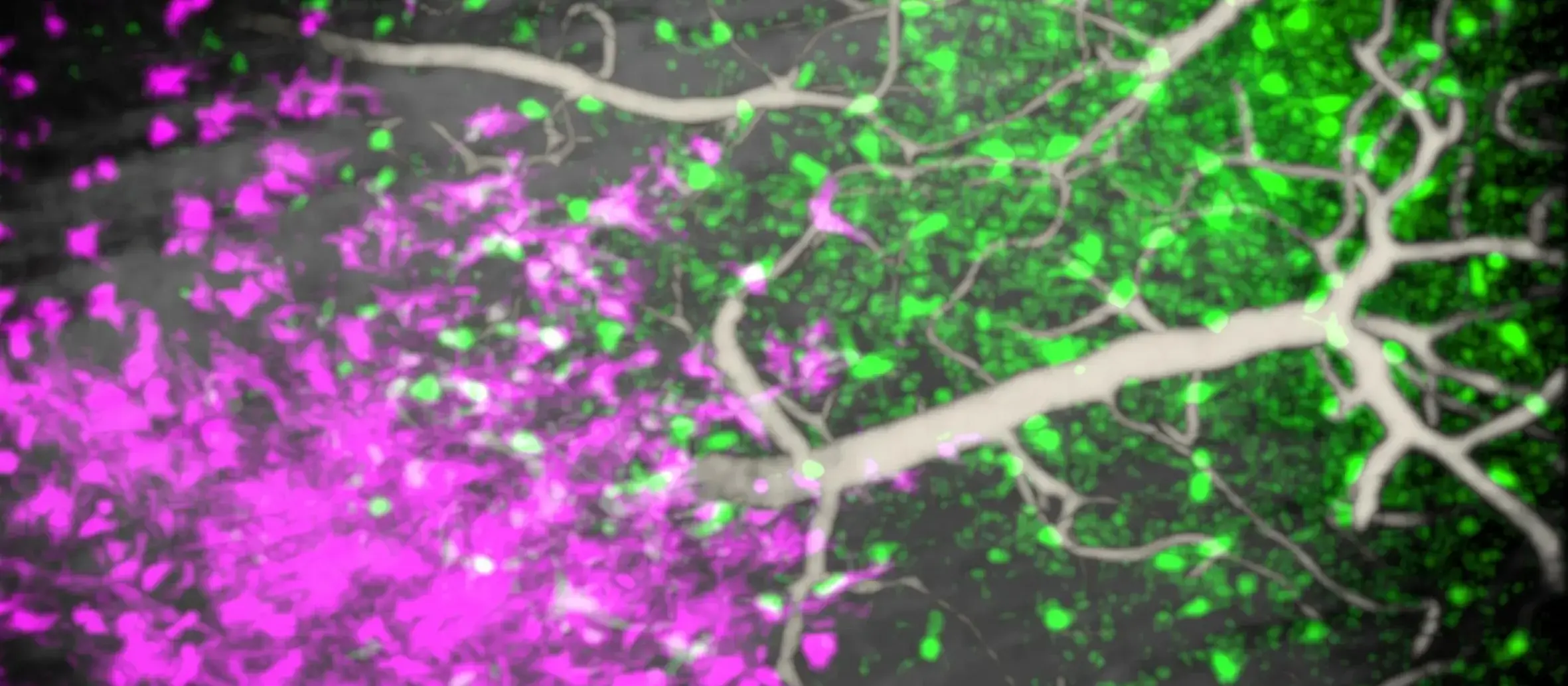 PM Immunity Nebeling