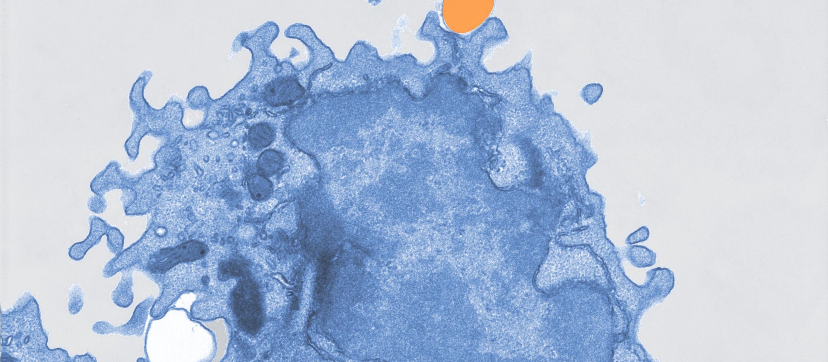 Pseudocolored electron microscope image of a macrophage