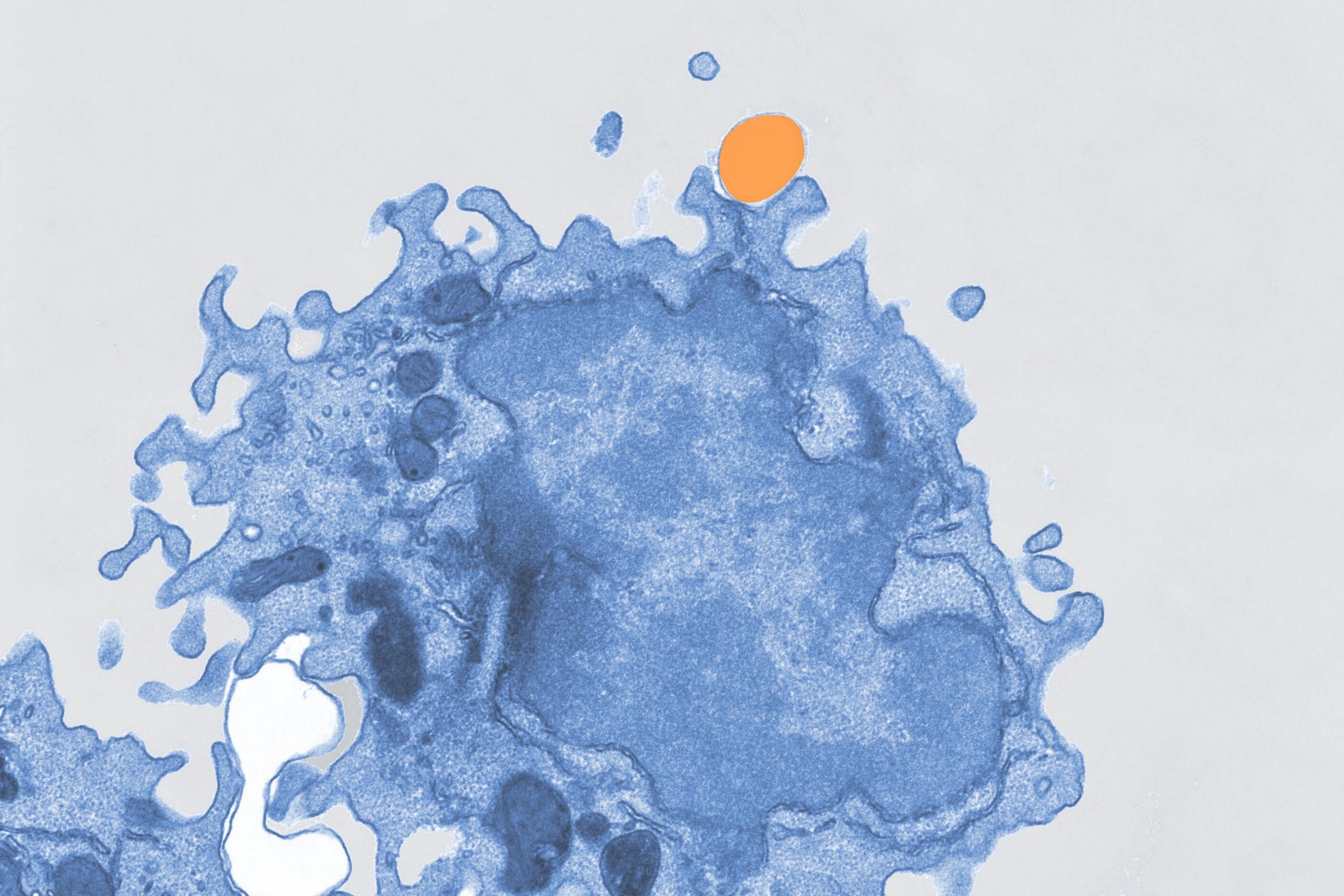 Pseudocolored electron microscope image of a macrophage
