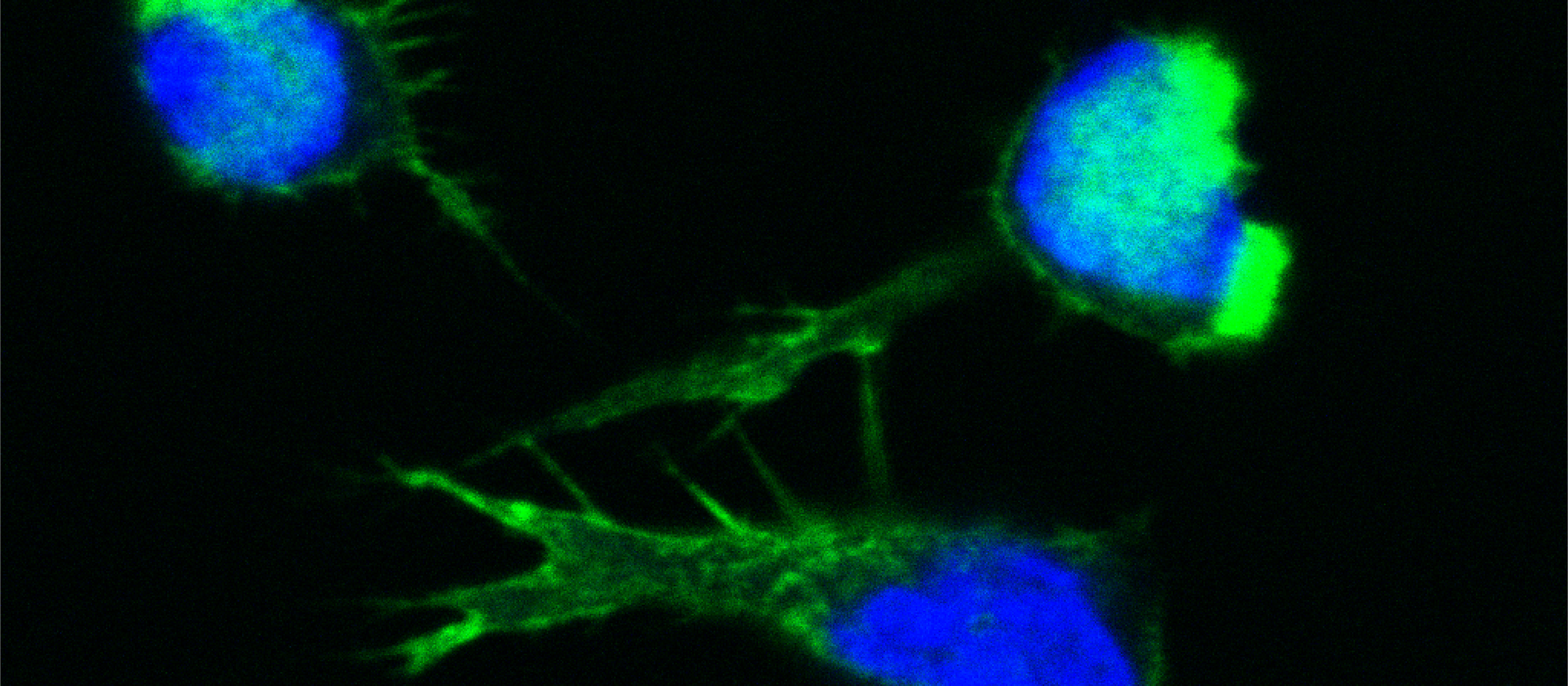 filamentous actin structures in T cells