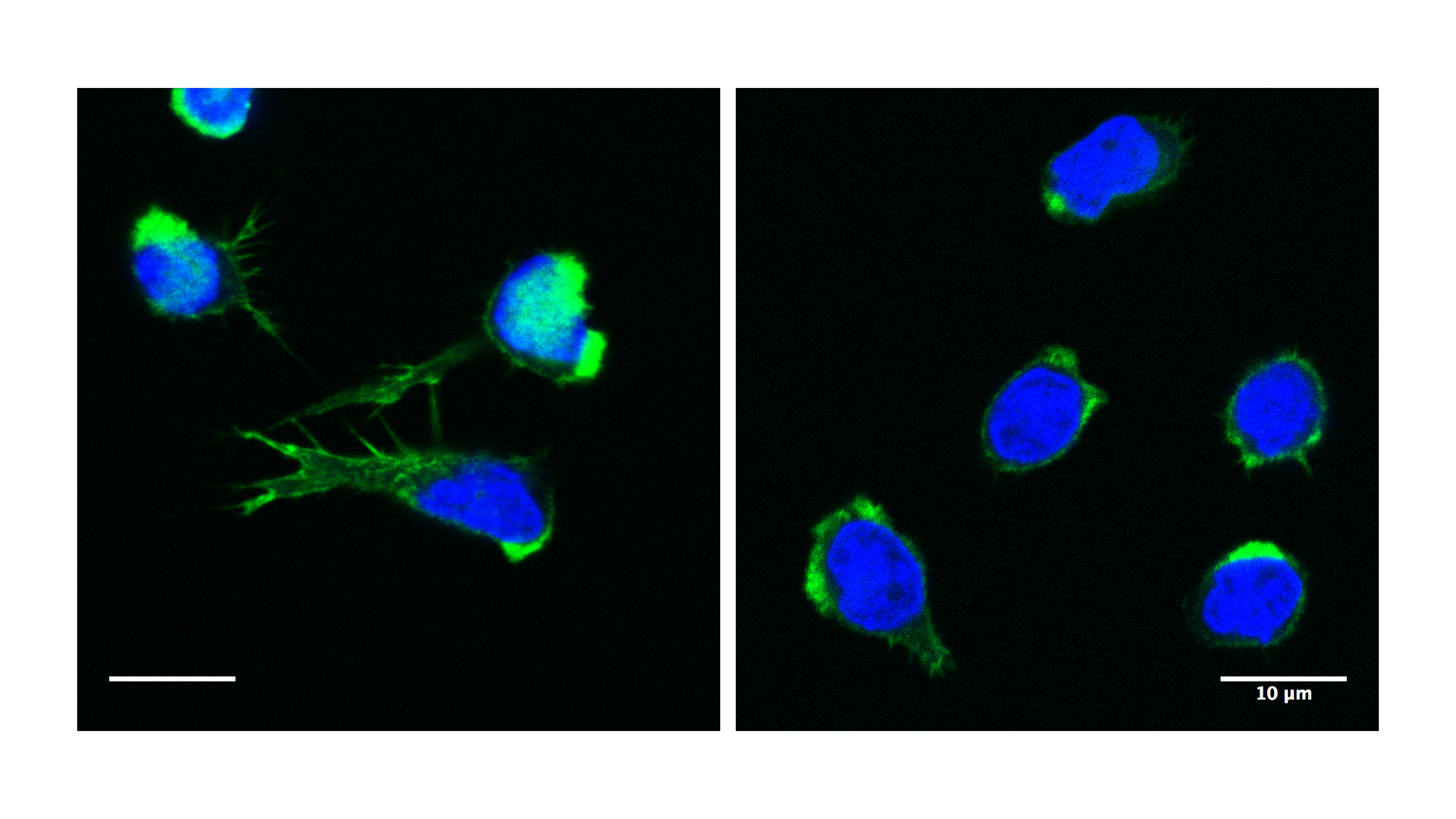 filamentous actin structures in T cells