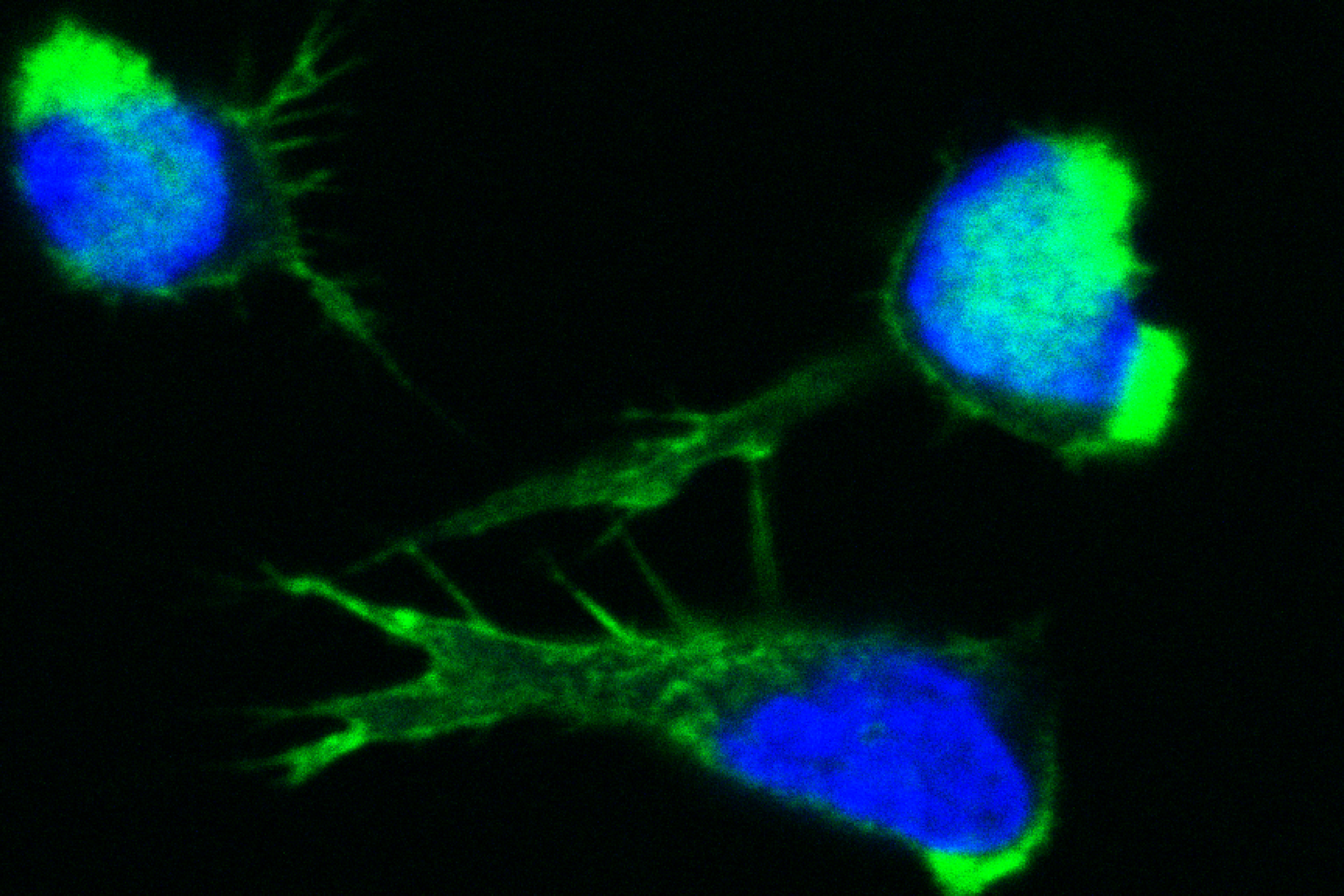 filamentous actin structures in T cells