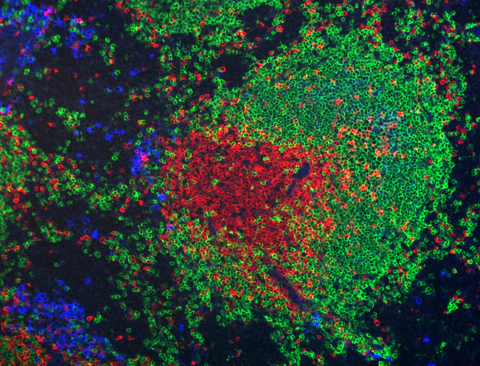 Immunofluorescence image showing T cells (red), B cells (green), and IgG1-positive B cells/plasma cells (blue) in the spleen of an immunized mouse.